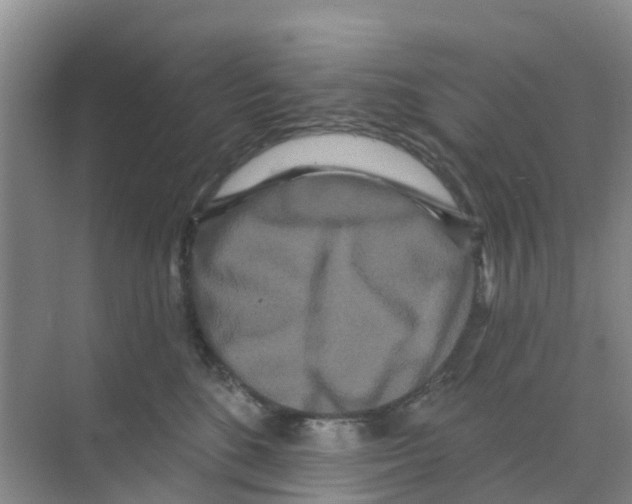 X0000070180520200606231950