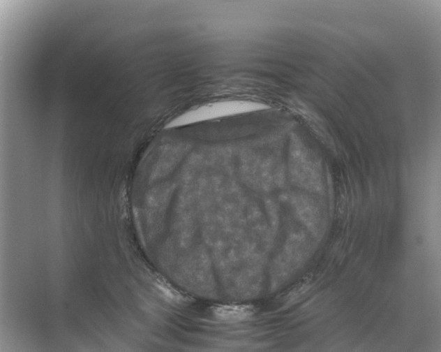 X0000070190465200606232017