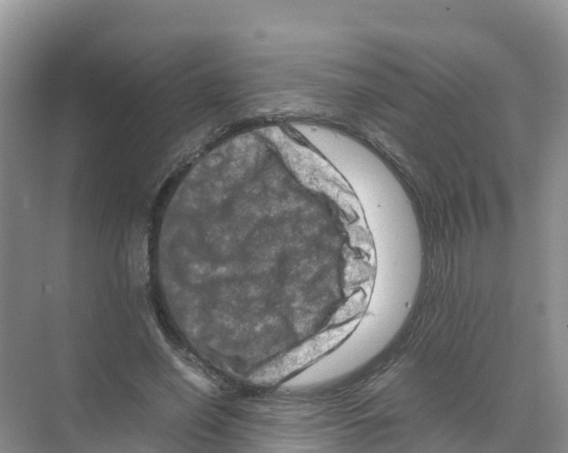 X0000070190638200606232013