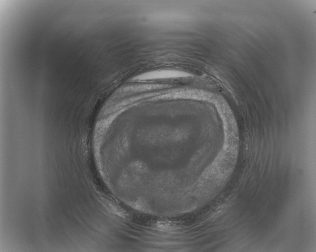 X0000070190641200606232014