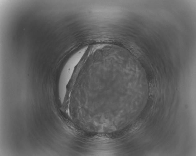 X0000070190648200606232014