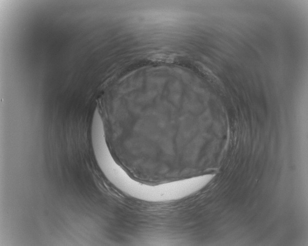 X0000070191154200606232005