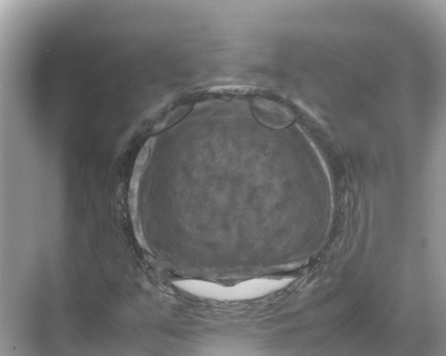 X0000070191351200606232002