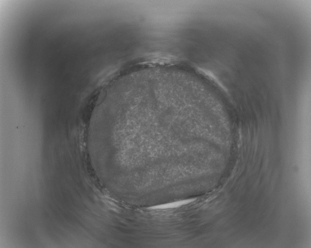 X0000070191399200606232000