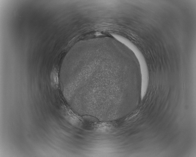 X0000070201155200606091551