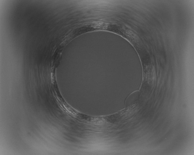X0000070251154200606021148
