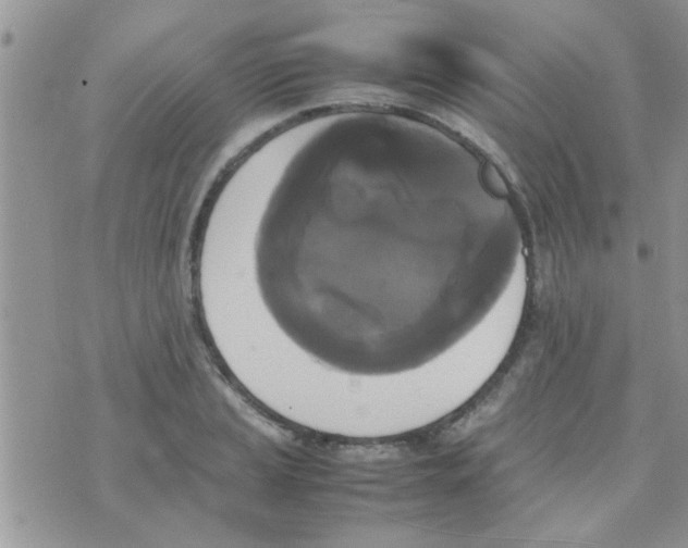 X0000070251037200606232003