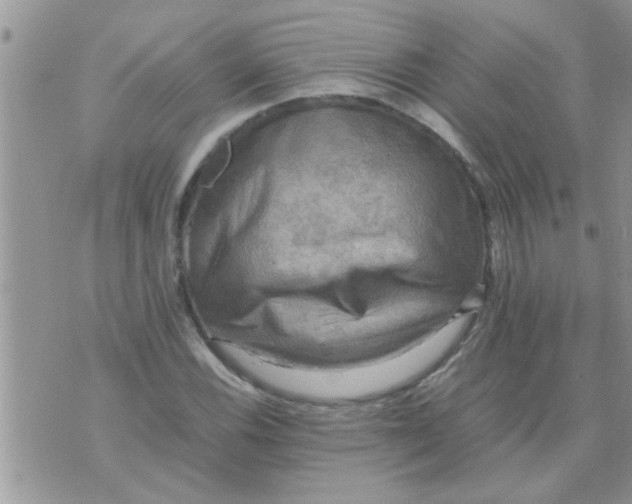 X0000070251116200606232001