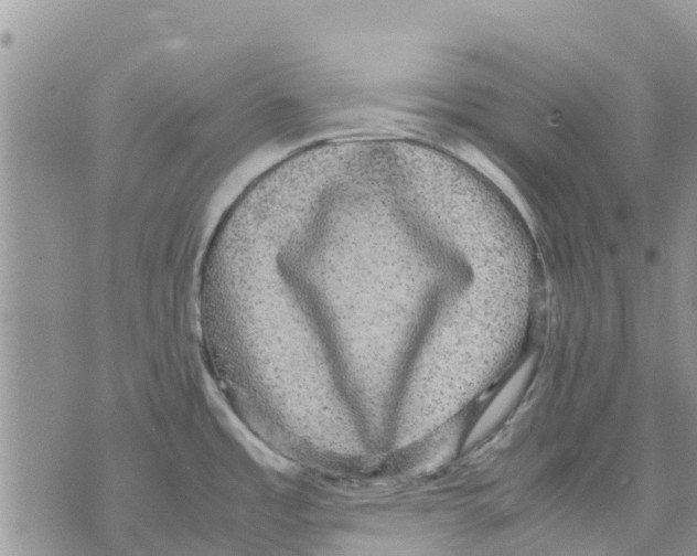 X0000070251485200606301613