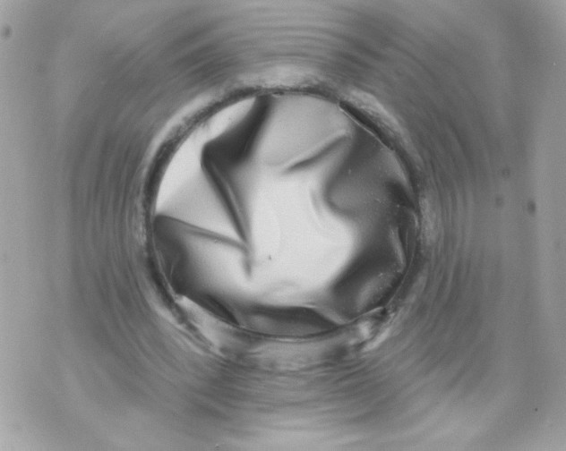 X0000070340392200607072018