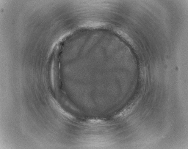 X0000070340399200607072018