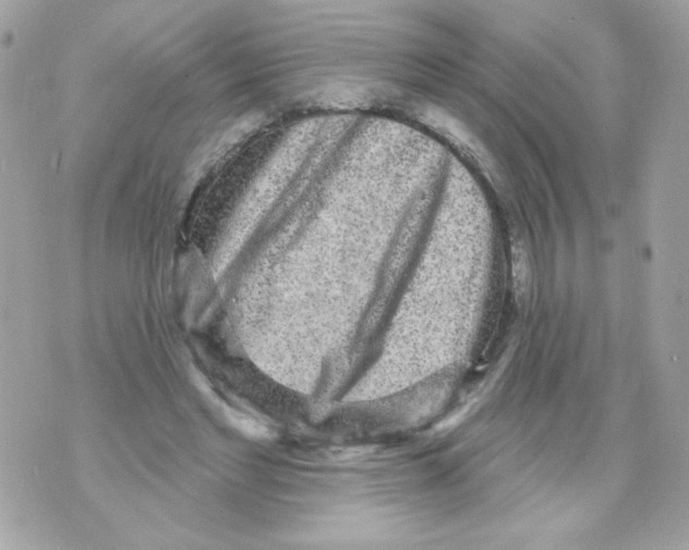 X0000070340493200607072016