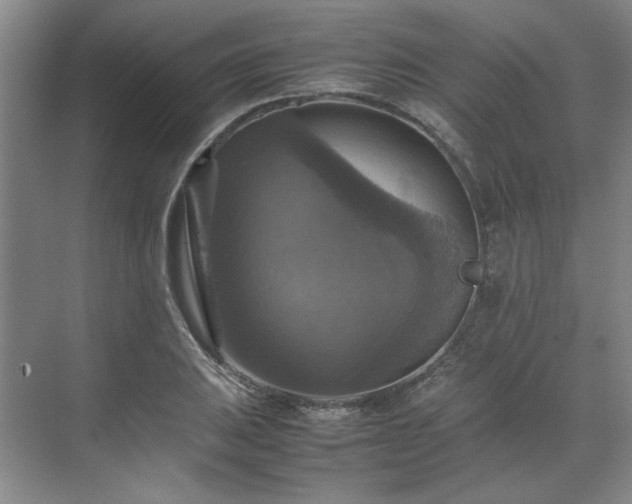 X0000070351031200606161311