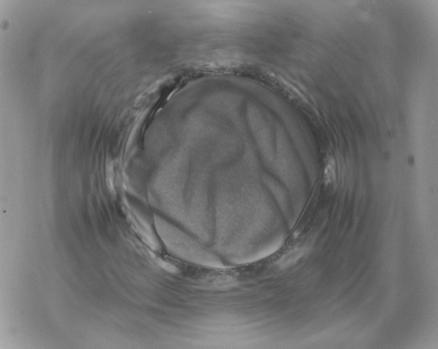 X0000070351156200607072031