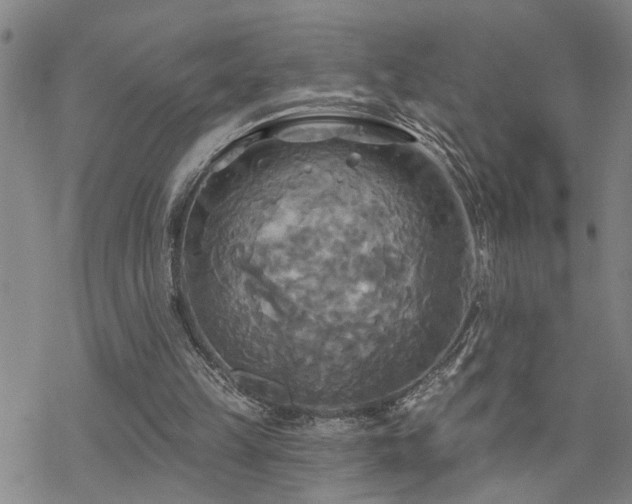 X0000070360149200606091040