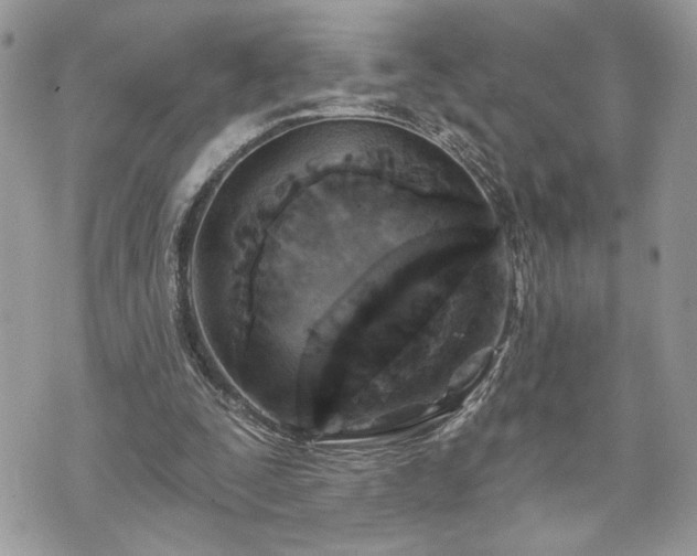 X0000070360295200606161259