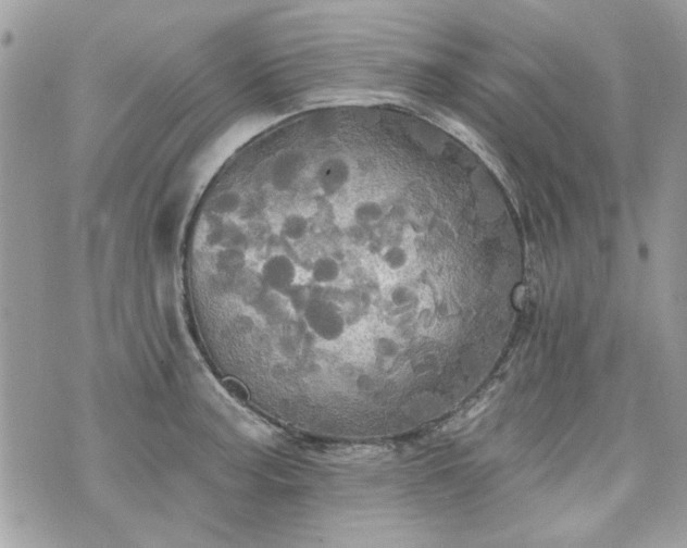 X0000070361187200606161244