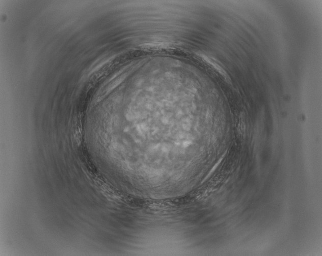 X0000070361015200606231617