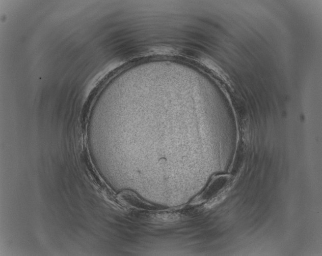 X0000070381117200606231705