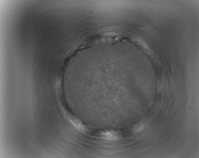 X0000070390365200606161416