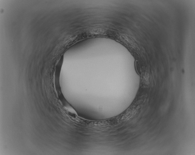 X0000070390817200606231735