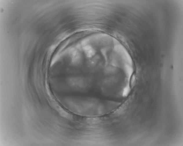 X0000070400145200607072252