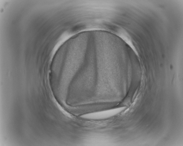 X0000070411197200606302028