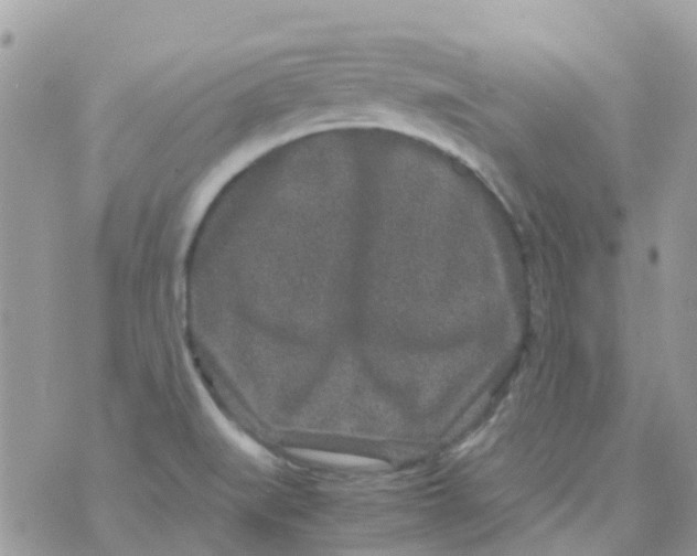 X0000070411519200606302023