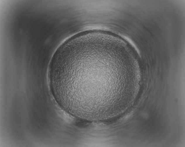 X0000070850983200606161130