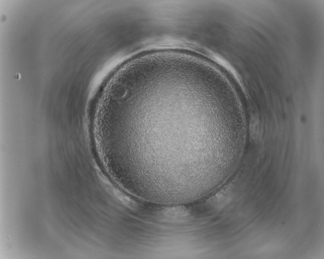 X0000070861464200606161128