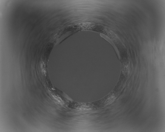 X0000070861010200606191311