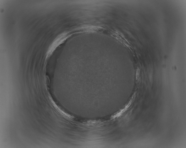 X0000070860101200606231303