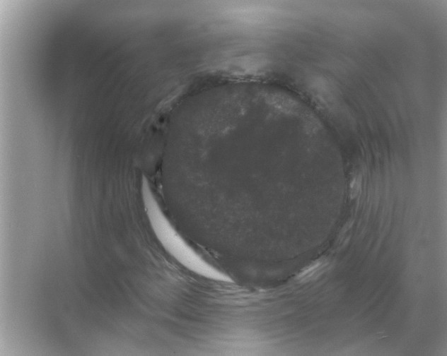 X0000070861156200606302038