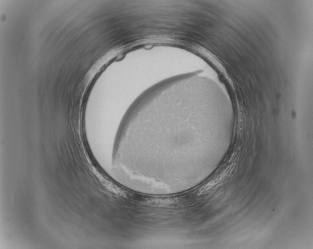 X0000070871245200607150113