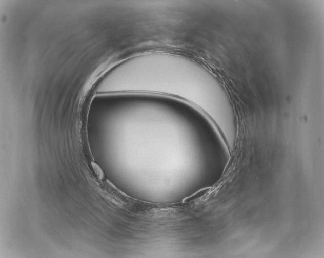 X0000070880150200606161020
