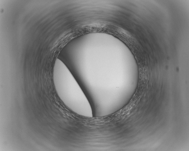 X0000070880774200606161010