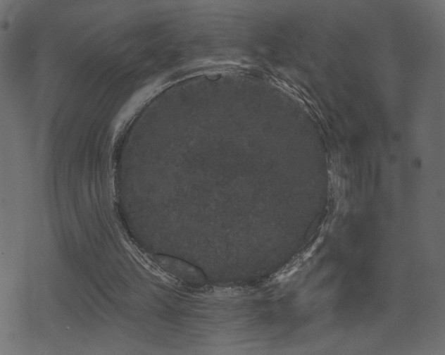 X0000071360149200606231208