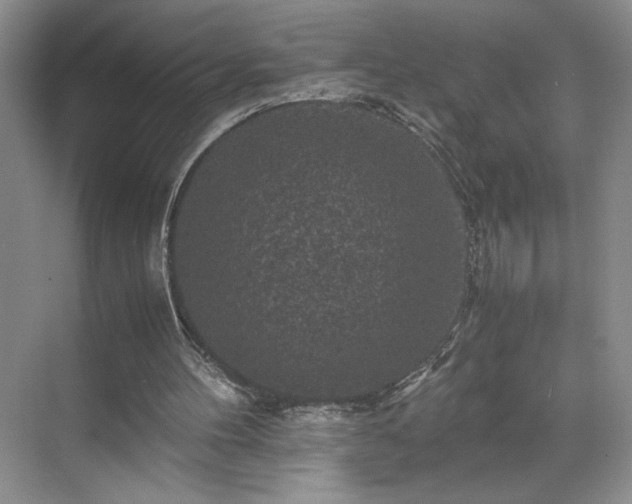 X0000071760100200607071246