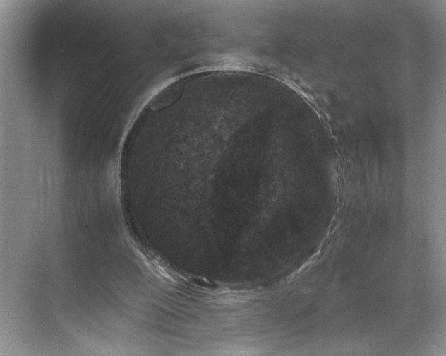 X0000071760200200607071244