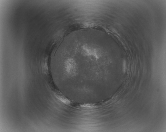 X0000071760516200607071239