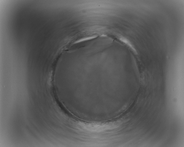 X0000071760018200607150014