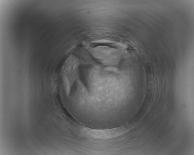 X0000071760030200607150014