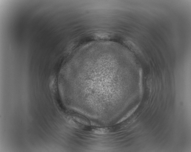 X0000071760079200607150013