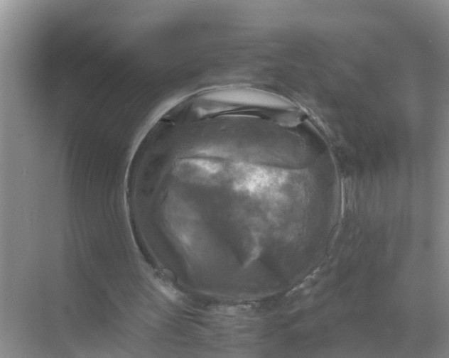 X0000071760147200607150011