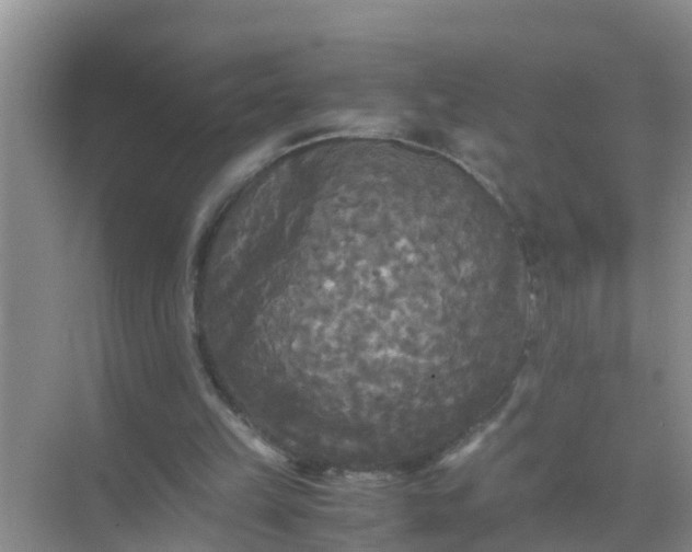 X0000071760149200607150011