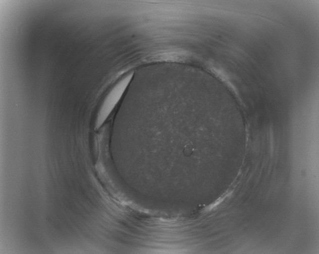 X0000071760154200607150011