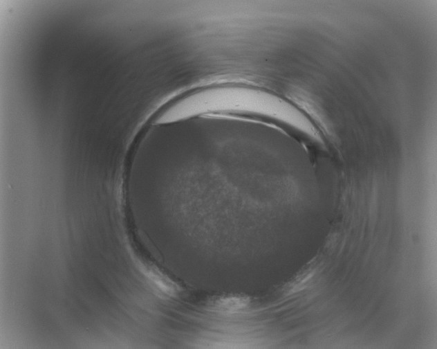 X0000071760156200607150011