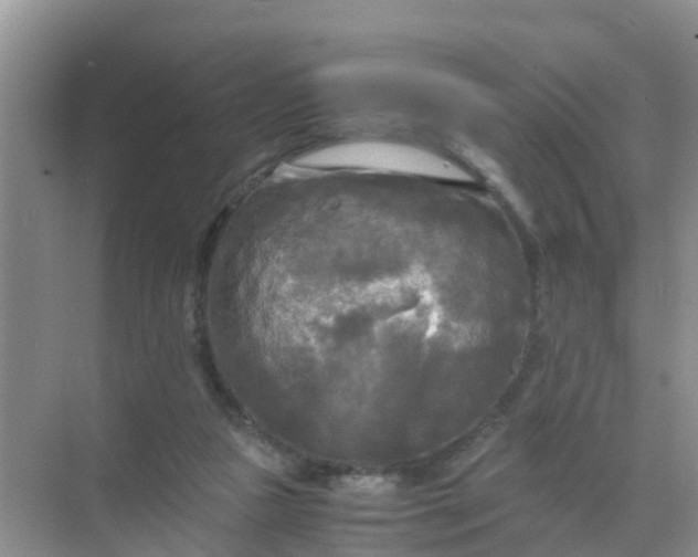 X0000071760161200607150011