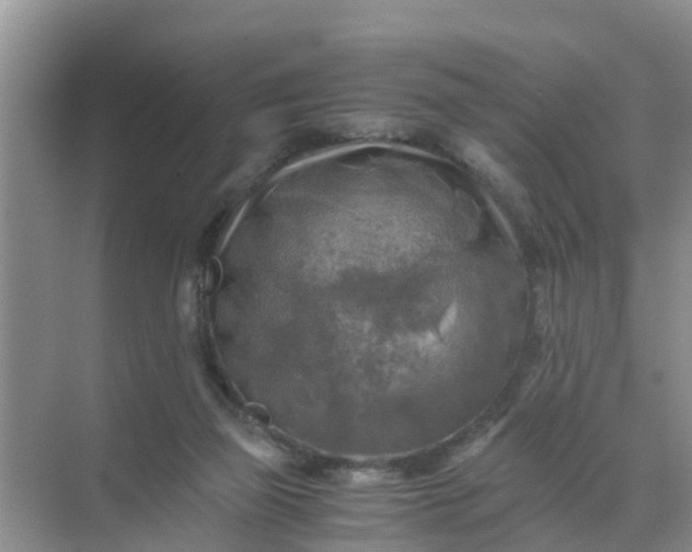 X0000071760165200607150011