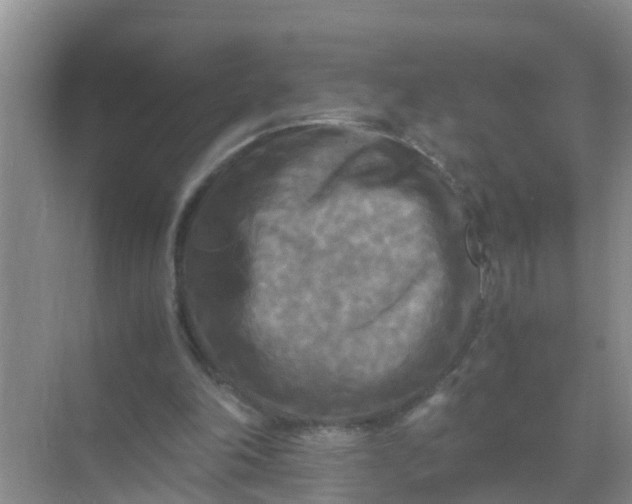 X0000071760198200607150011